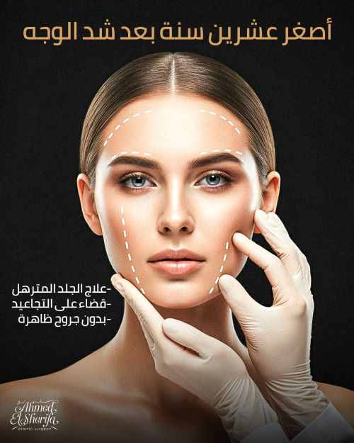 اصغر عشر سنين بعد شد الوجه